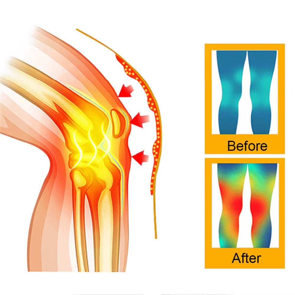 2PCS Self Heating Support Knee Pad Knee Brace Warm for Arthritis Joint Pain Relief Injury Recovery Belt Knee Massager Leg Warmer